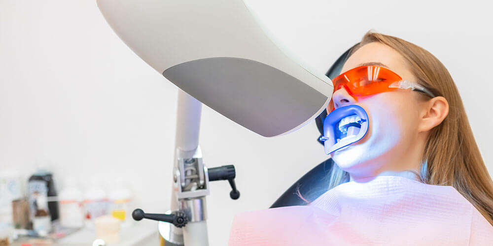 Blanchiment des dents Saint-Lazare